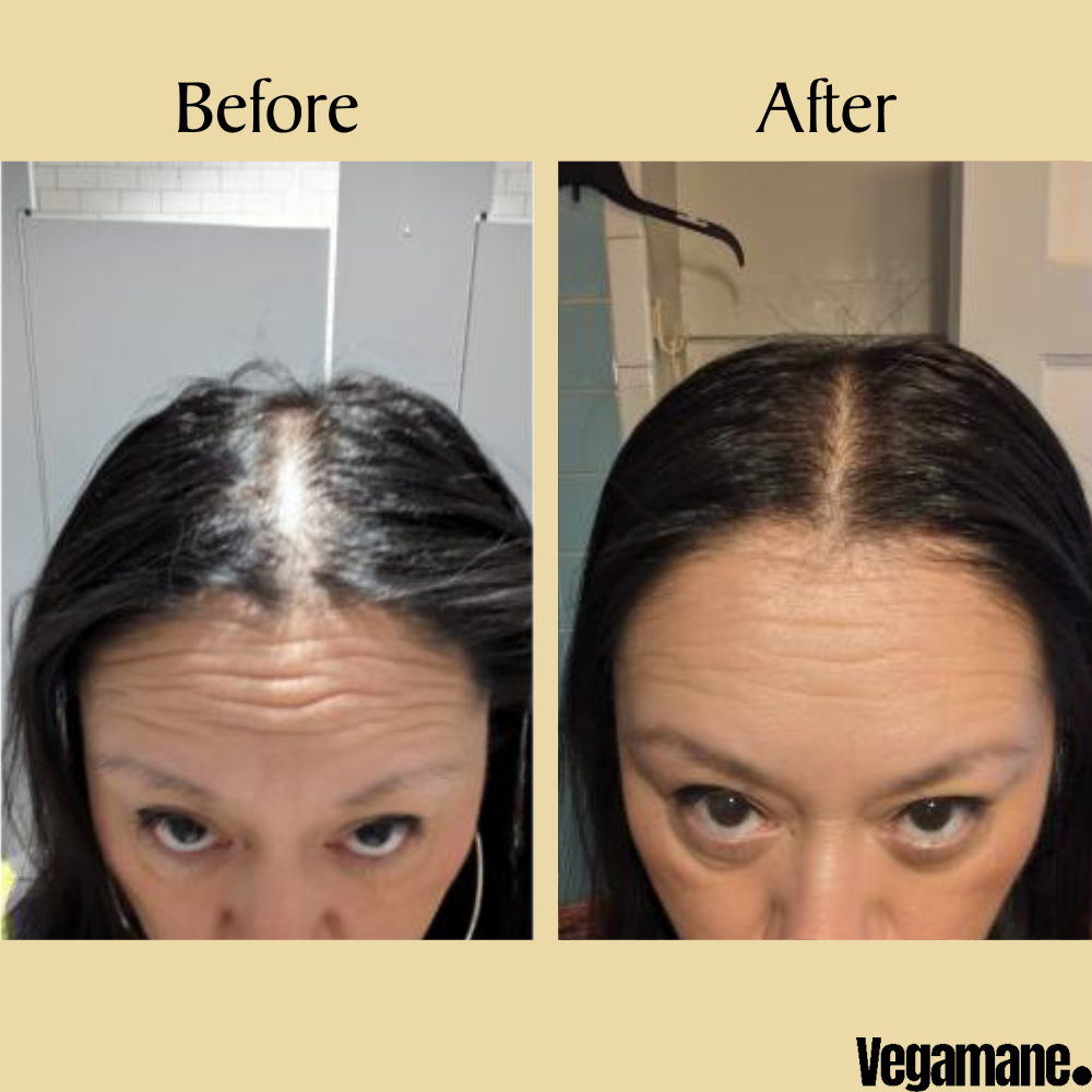 Vegamane™ Natural Hair Growth Oil